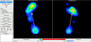 Πελματογράφημα | Life Ergo