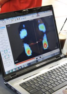 Πόνος στο Πέλμα - Πελματιαία Απονευρωσίτιδα