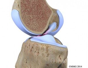 Πρόσθιος Χιαστός Σύνδεσμος (ACL)